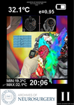 Archives of Neurosurgery Cover Art Volume 1 Issue 2 by José Alberto Israel Romero Rangel
